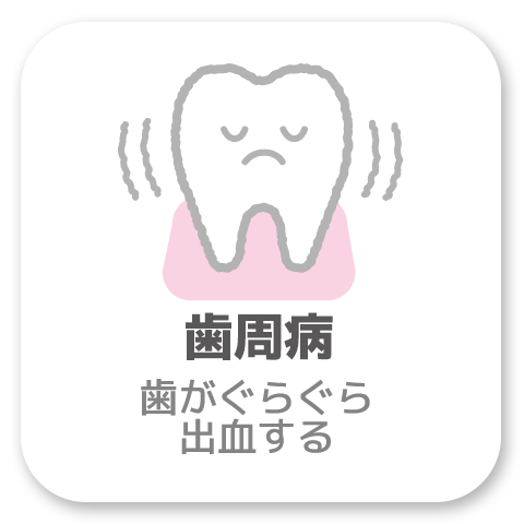 高津・溝の口の歯医者・歯科なら「ながれ星歯科」歯周病について